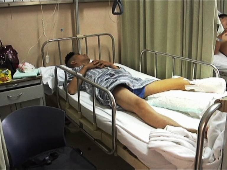 सफाई करताना कर्मचारी एस्कलेटरमध्ये अडकला, पाय कापल्यानंतर सुटका