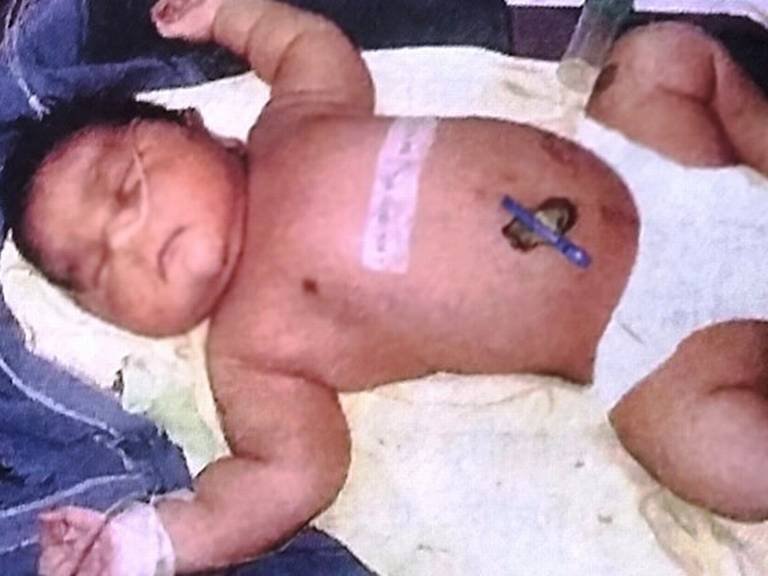 राजस्थानमध्ये देशातील सर्वात ‘वजनदार’ बाळाचा जन्म, वजन तब्बल 6 किलो!