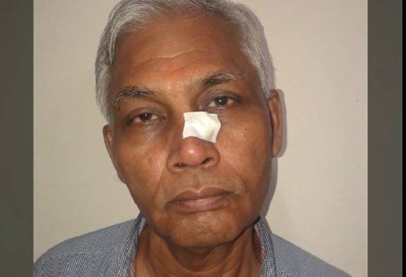 मीरारोडमध्ये आजोबांचा दुसऱ्या आजोबांना ठोसा, संगीतखुर्चीत पत्नीला हरवल्याचा राग