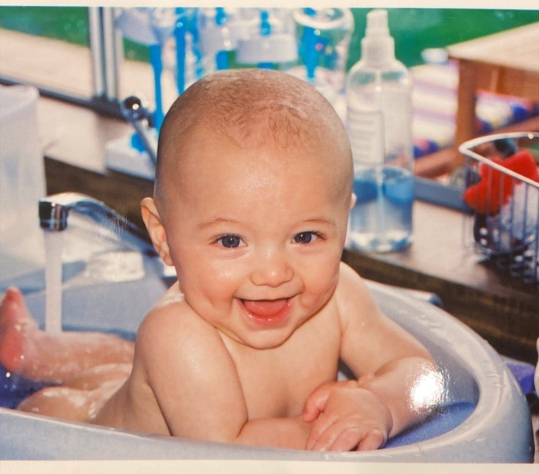 स्वस्त साबण वापरणं पडलं महागात, चिमुकल्याच्या अंघोळीदरम्यान फेसामुळे लागली आग