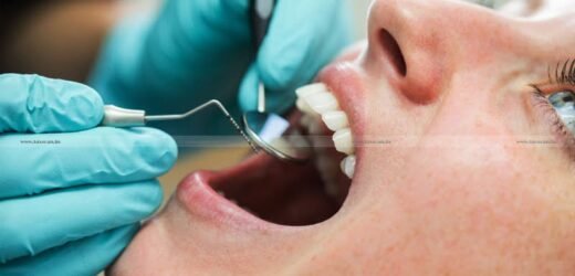 Maharashtra: Teeth whitening or Smile fixing treatment will now draw 18% GST